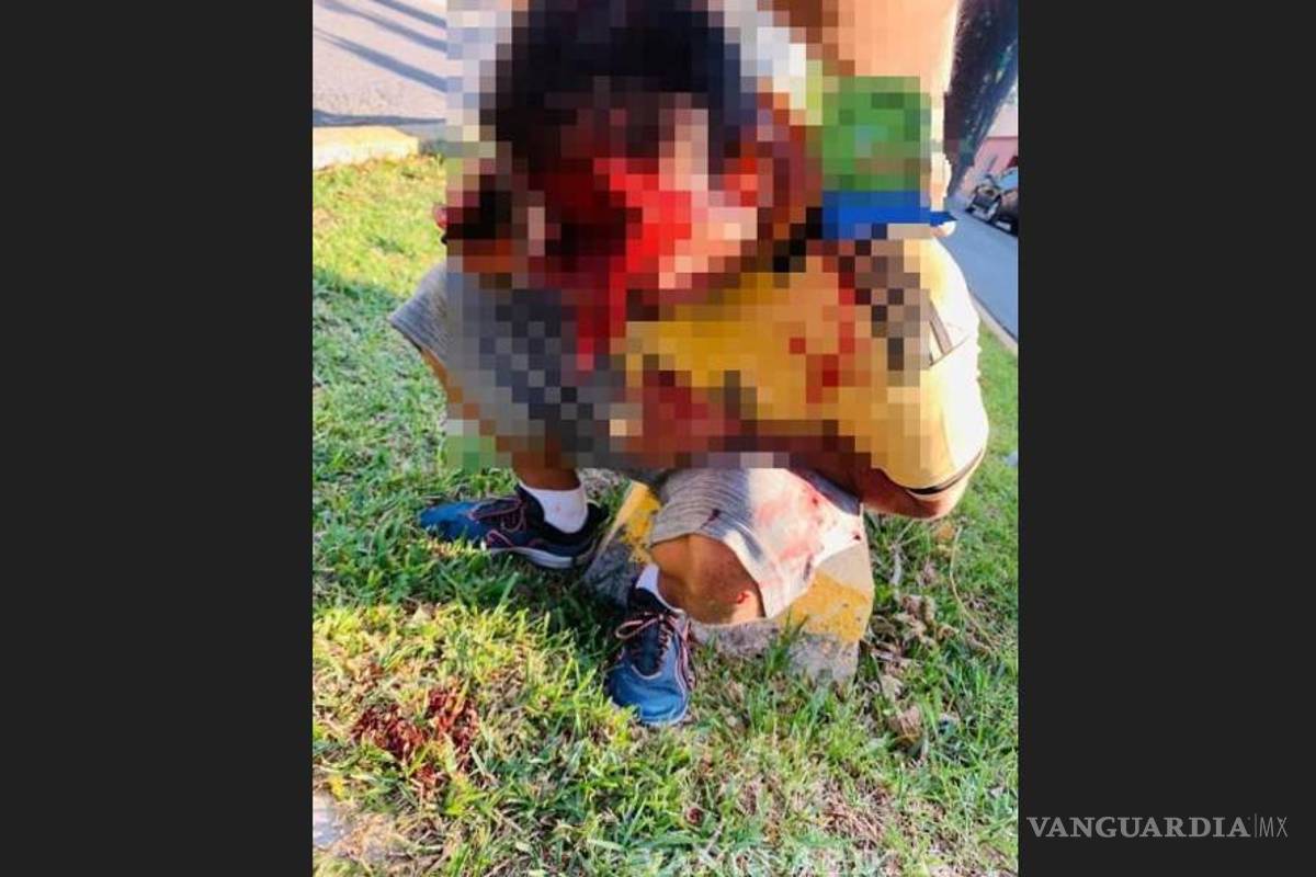 Dan de alta a hombre que cayó de bicicleta y se le desprendió la piel de la cara, en Parras