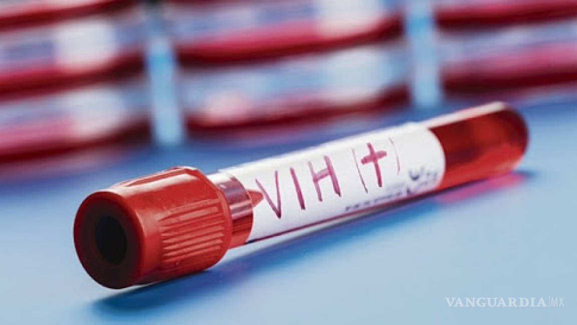 Caen hasta 80% detecciones de VIH ante pandemia