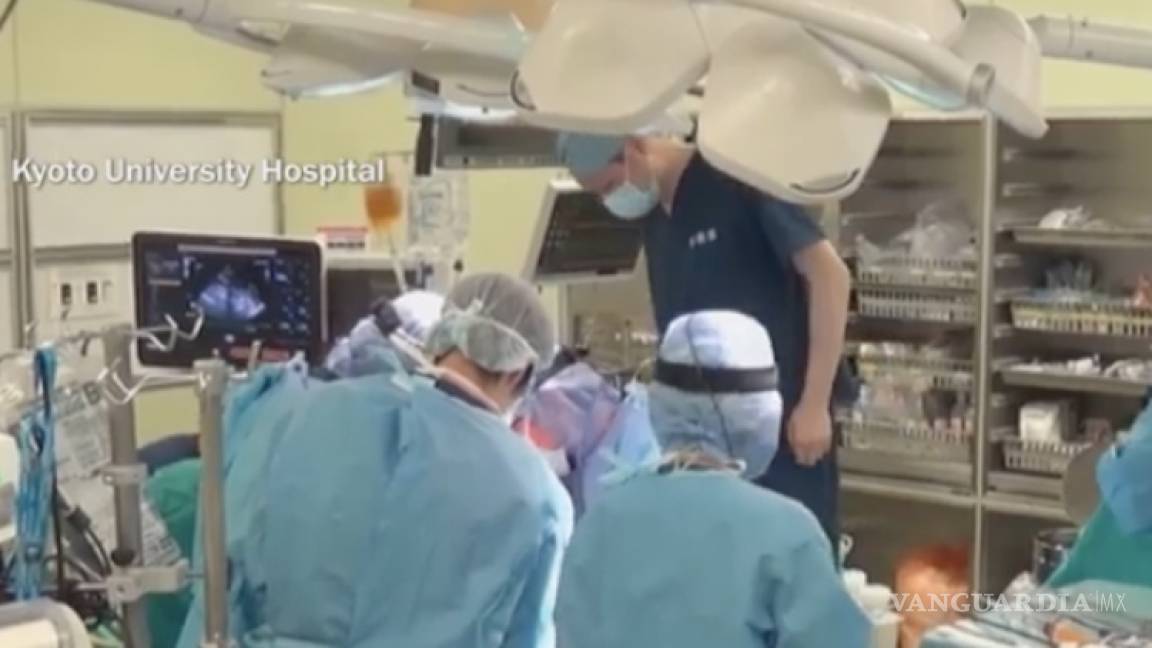 Realizan en Japón el primer transplante del mundo de tejido pulmonar a una paciente de COVID-19