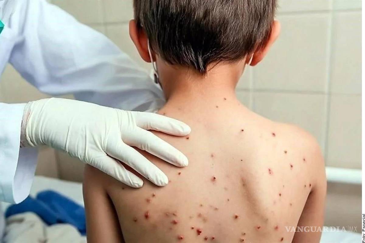 Prohíben posadas y reuniones navideñas en Chiapas, por casos de Sarampión