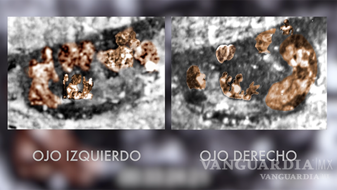 $!Virgen de Guadalupe... ¿Qué misterio se esconde en sus ojos y quiénes son las 13 personas que se reflejan en ellos?