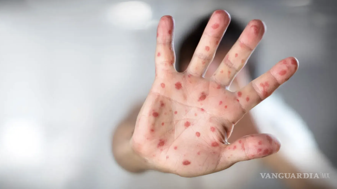 $!La mayoría de los estados reporta cifras controladas, siete entidades concentran los llamados “focos rojos”.