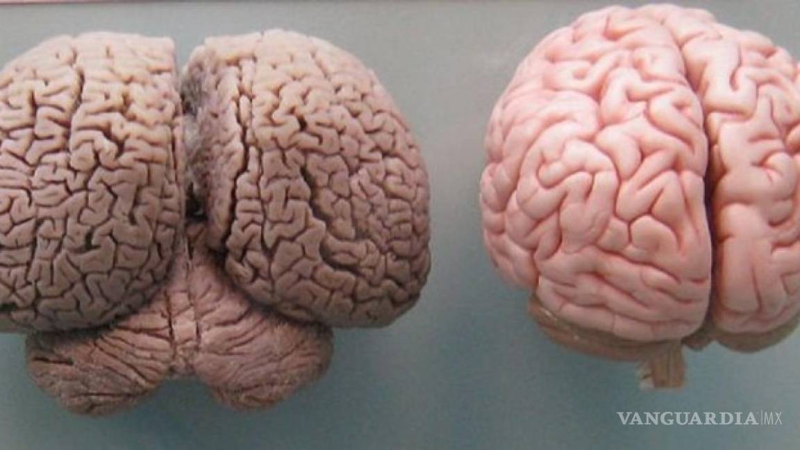 Cuanto más grande es el cerebro, mejor se resuelven los problemas