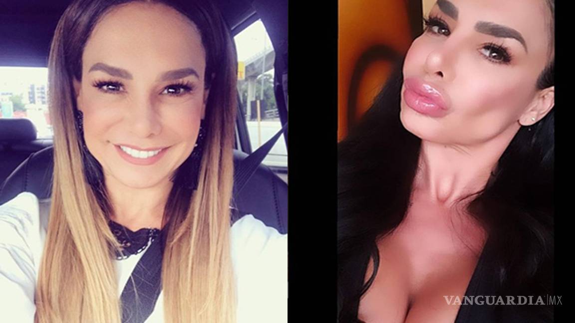 $!No solo es la Guzmán; estas celebridades quedaron peor con sus cirugías