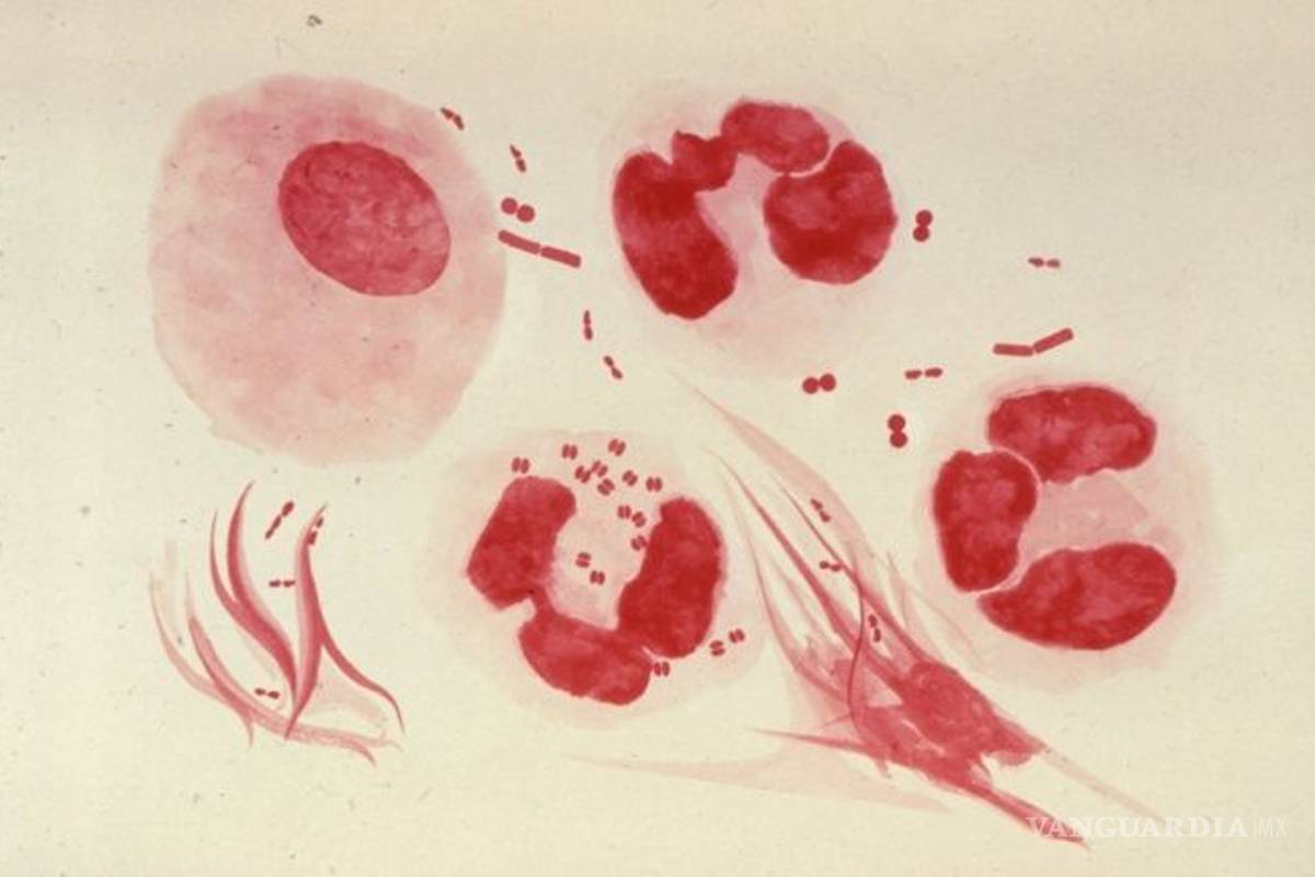 La peligrosa enfermedad sexual que se dispara en Australia