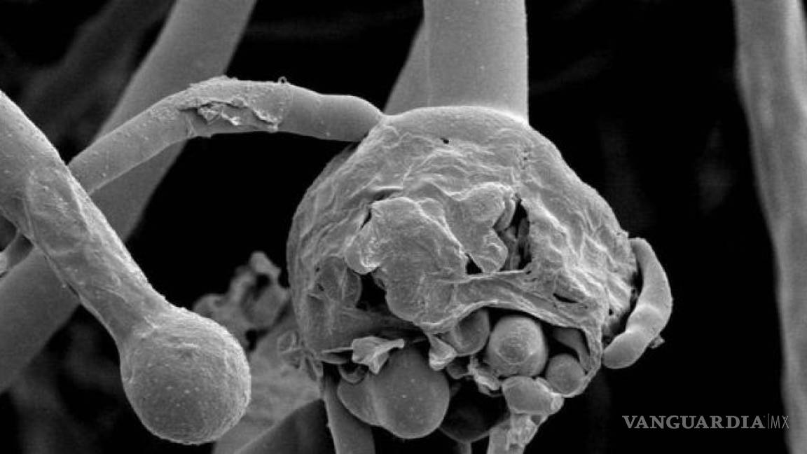 ¿Es contagioso el hongo negro?, lo que hay que saber