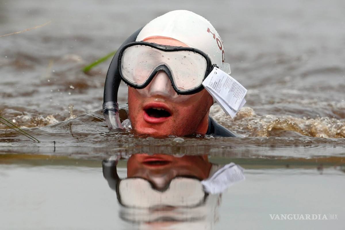 $!¿Sabías que en nuestros pulmones habitan microorganismos que nos protegen del asma?