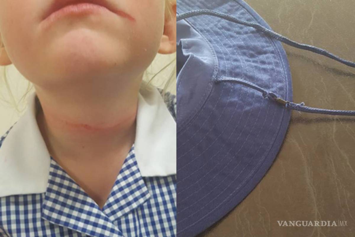 Niña de 6 años estuvo a 45 segundos de morir, pero su amiga la salvó