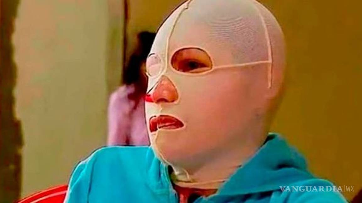 $!Catean casa de exfuncionario acusado del ataque con ácido a saxofonista, pero no lo encuentran