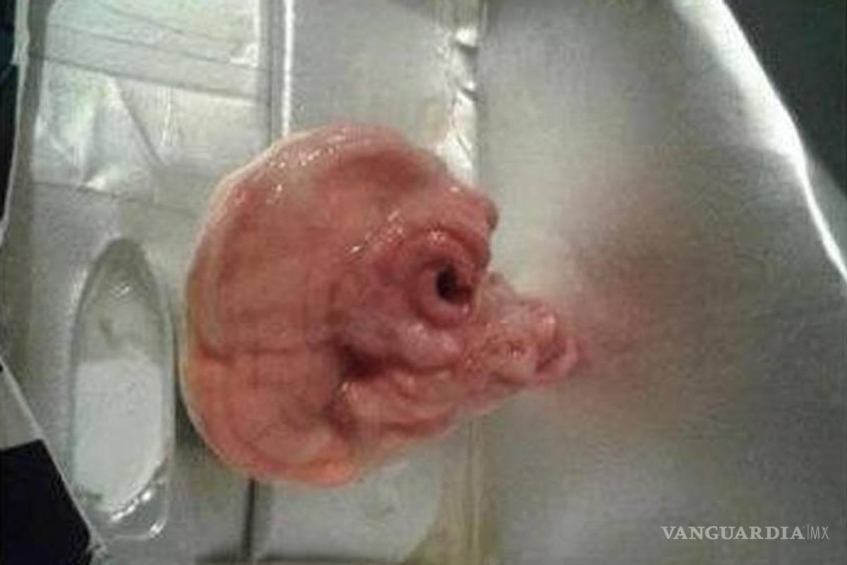 Trozo de "carne" en envase de JUMEX provoca revuelo en redes sociales