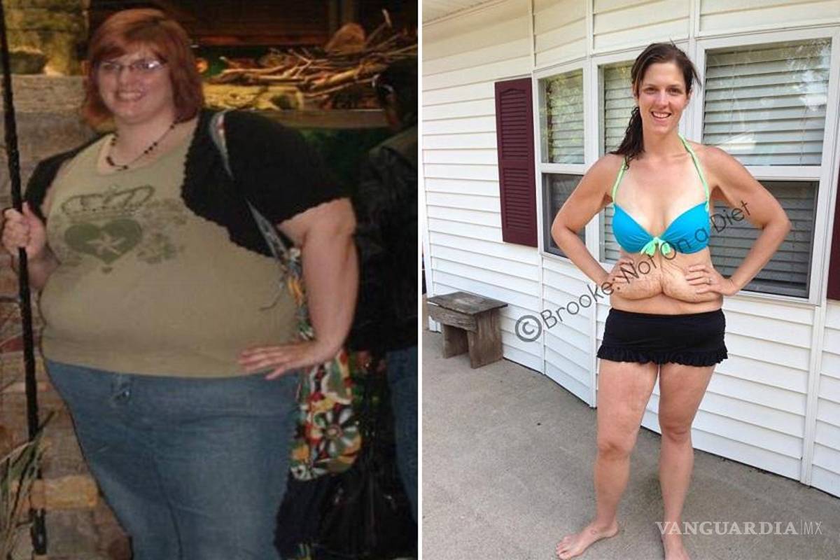 Polémica por foto de mujer en bikini que bajó 78 kilos