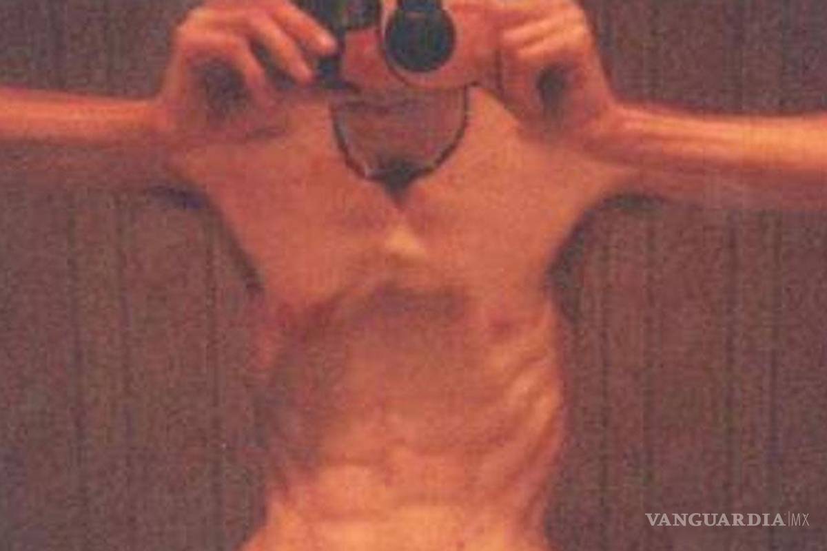 La anorexia también ataca a los hombres