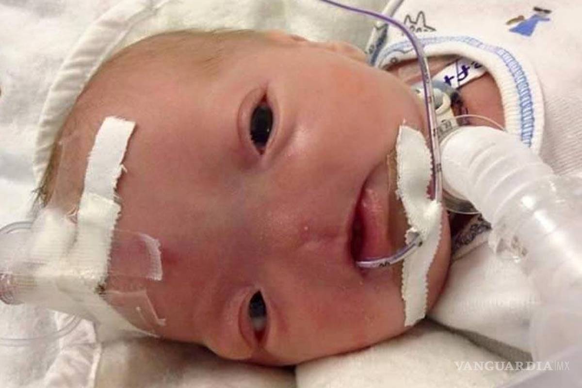 Conoce la historia de Eli Thompson, un bebé que nació sin nariz