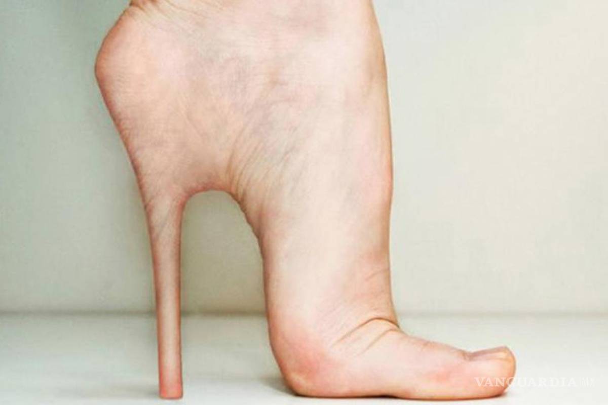 Cirugía cenicienta: una dolorosa y polémica tendencia en tratamientos estéticos