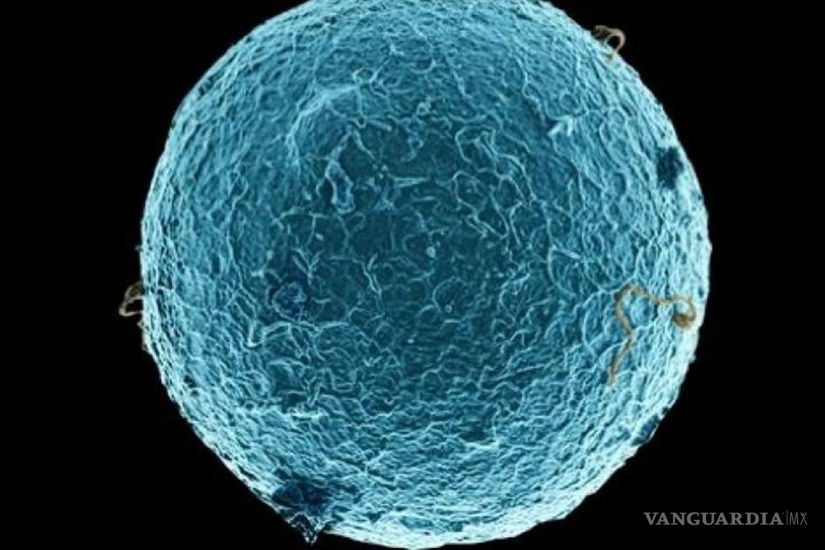 Un tipo de esclerosis, frenado con inyección de células madre