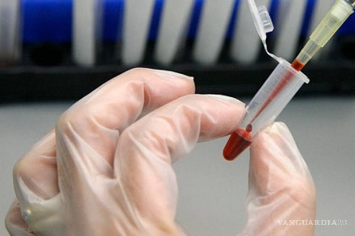 Tener VIH no es lo mismo que tener SIDA