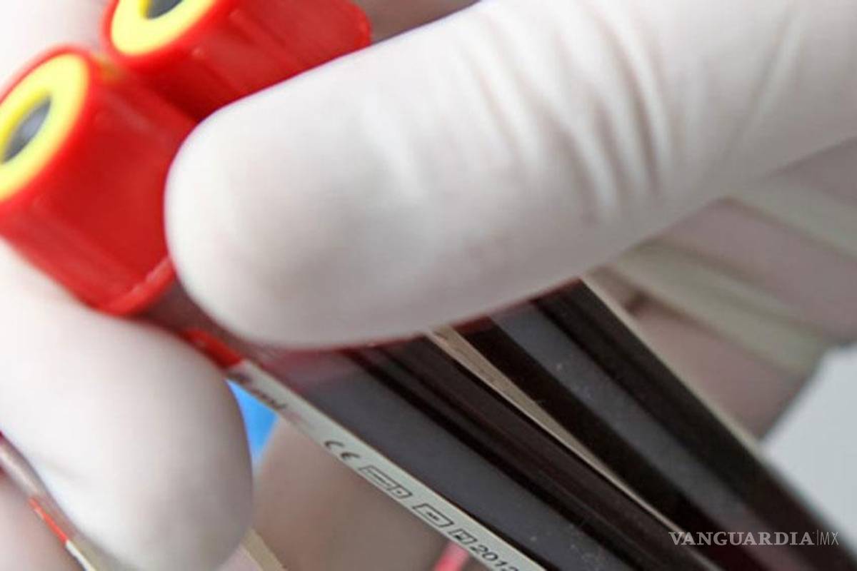 Científicos hallan células donde se aloja VIH