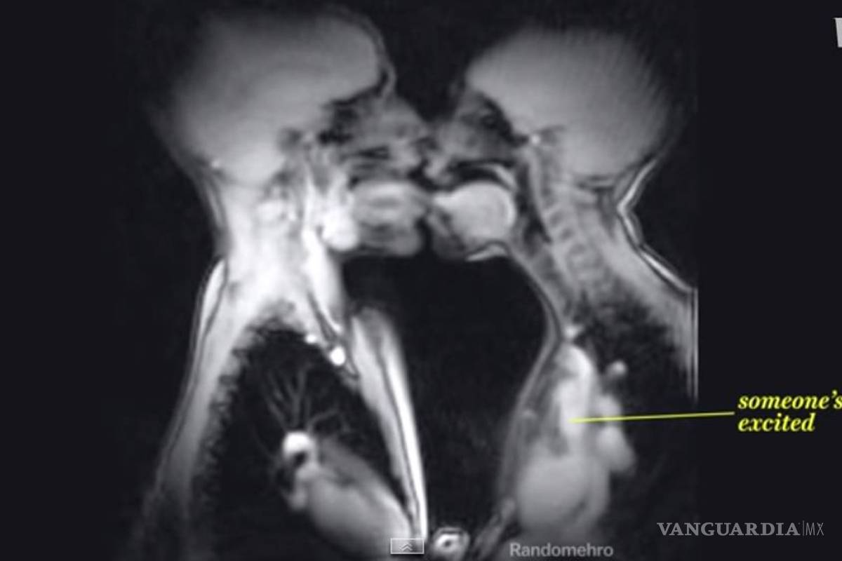 Así responde el interior de nuestro cuerpo cuando tenemos sexo