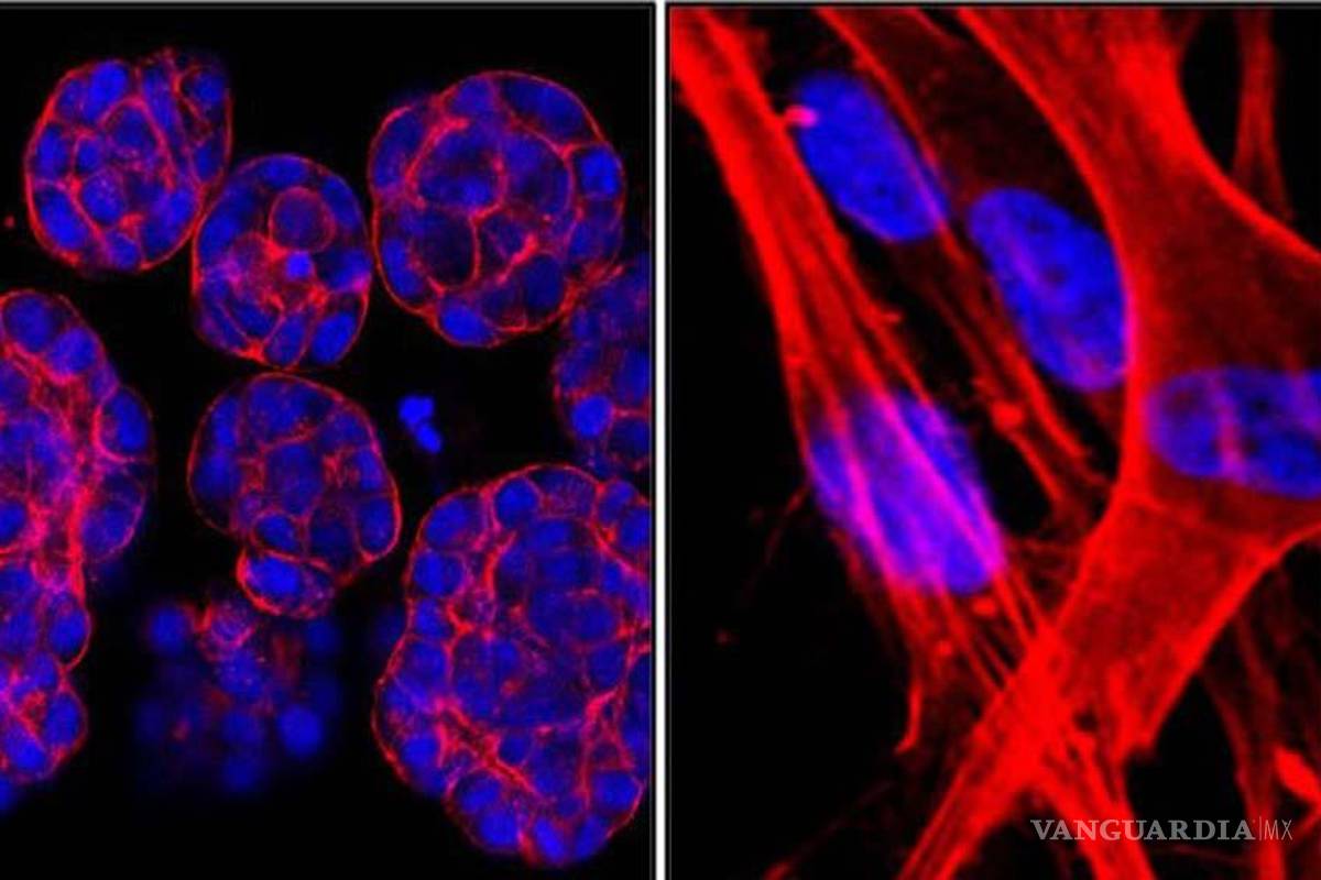 Hipertermia, calor contra el cáncer