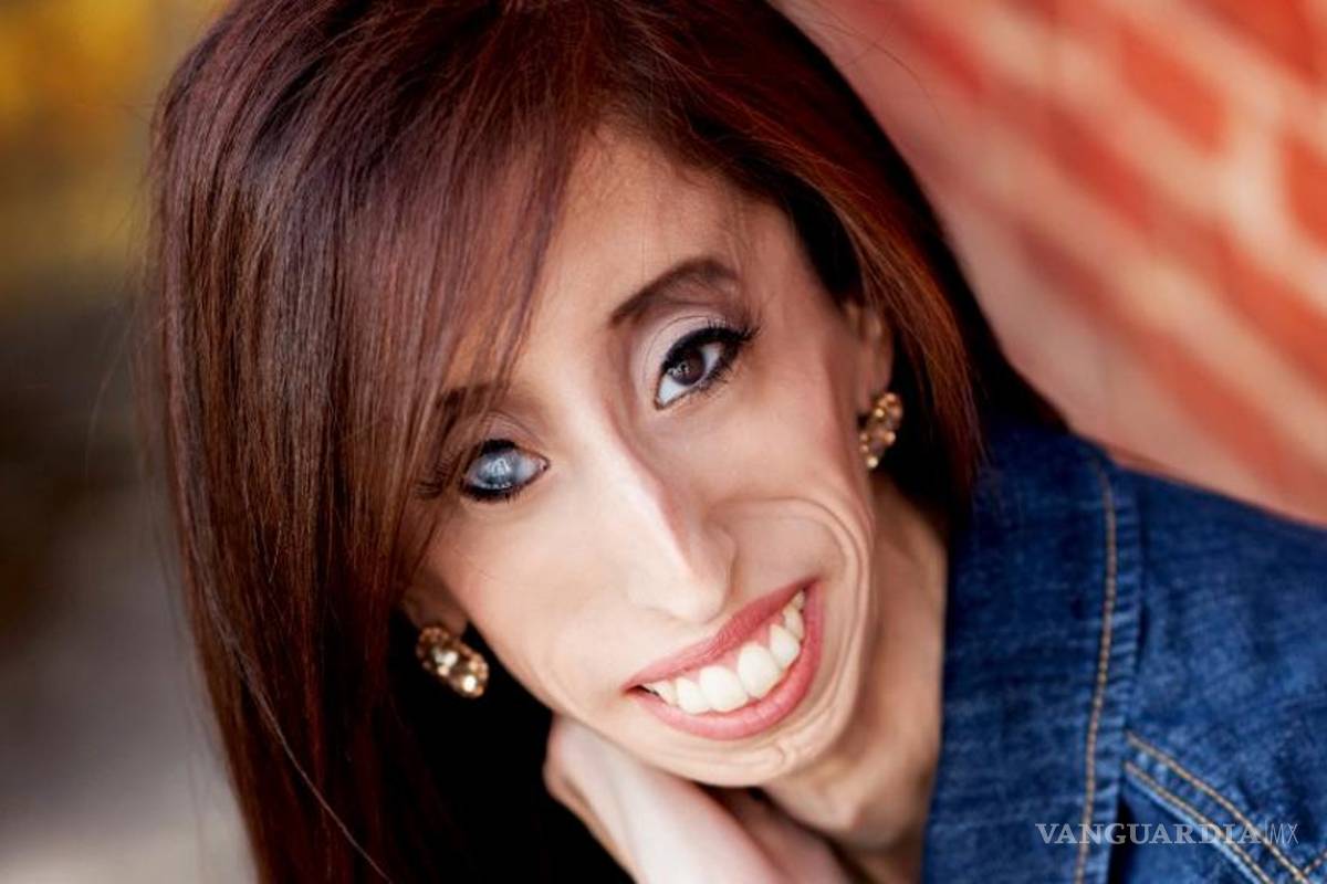 La emotiva historia de Lizzie Velásquez, la mujer con el físico menos agraciado