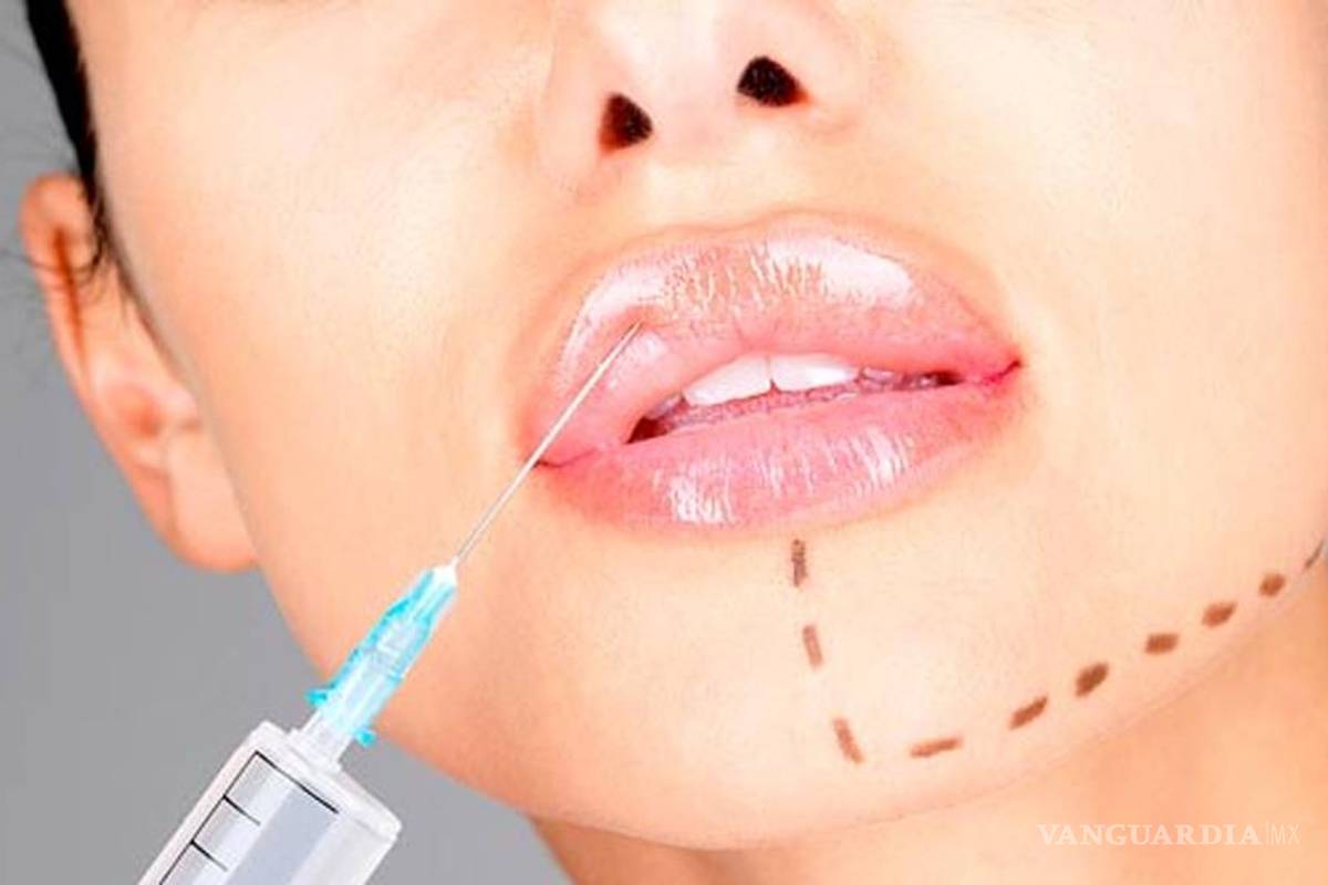 Las 12 cosas que debes saber del botox