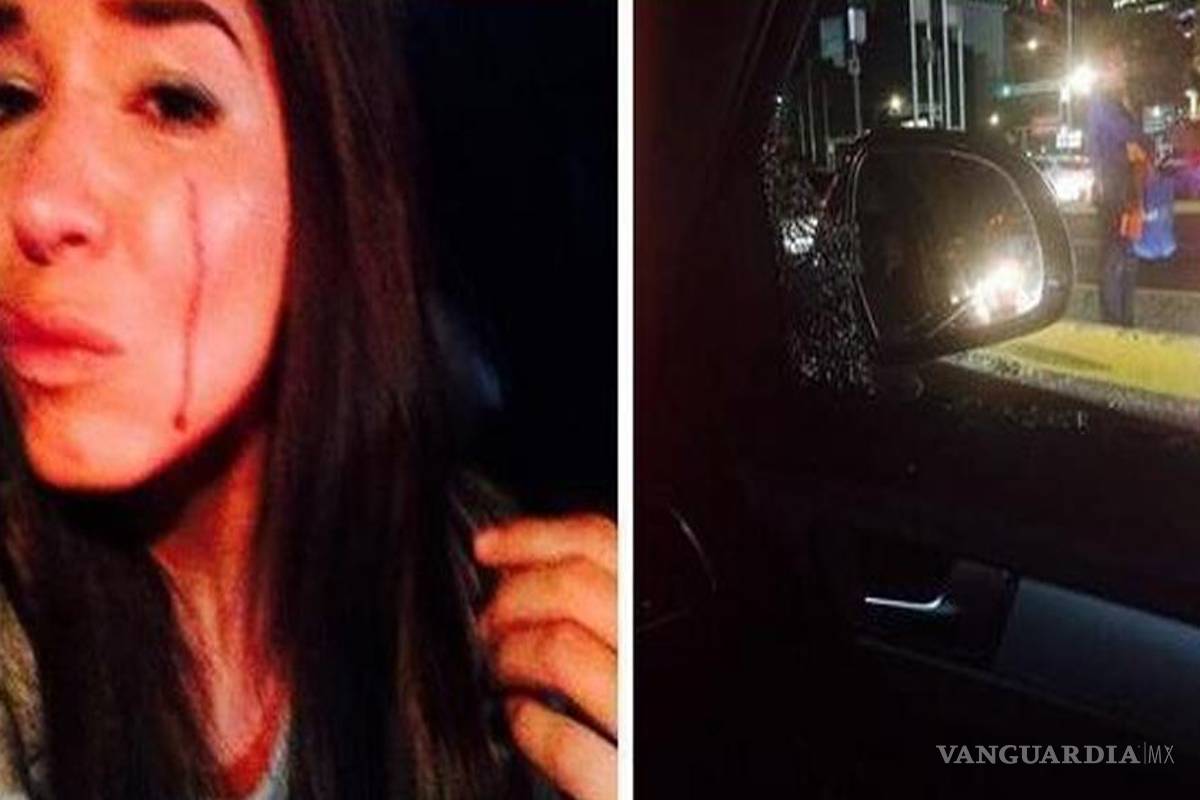 Laura G causa burlas en Twitter por su 'selfie' post-asalto