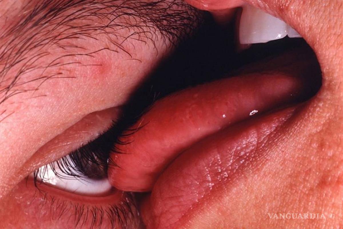 Lamerse la córnea es la última moda en Japón