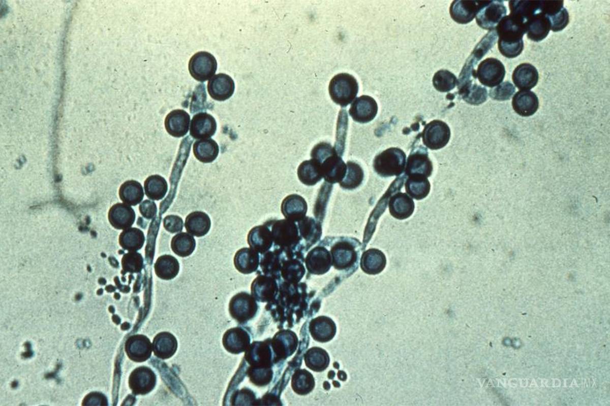 Diabetes puede provocar candidiasis vaginal