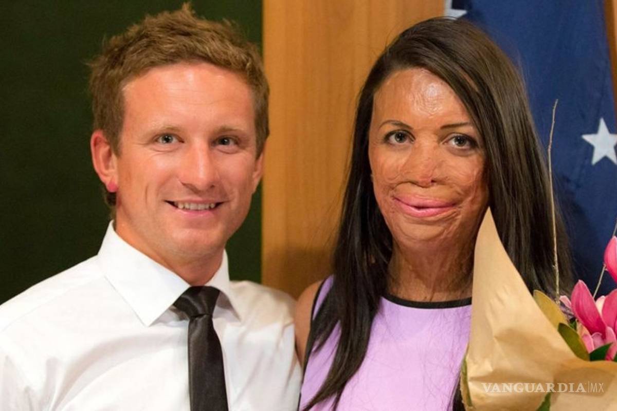 Turia Pitt, modelo víctima de quemaduras, se casará