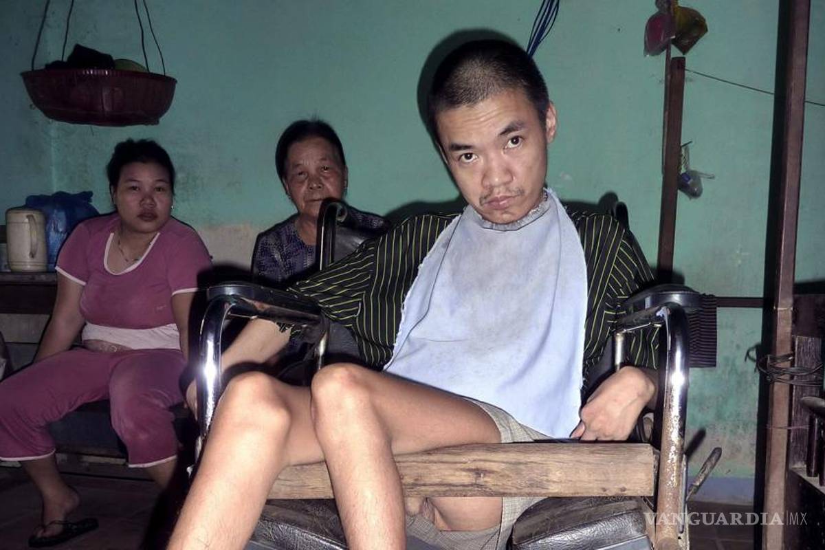 Armas químicas de EU siguen afectando a miles de víctimas en Vietnam