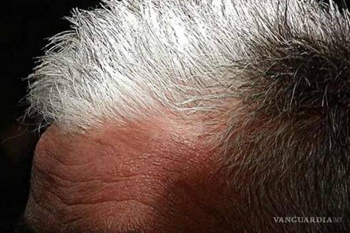 Las canas podrían llegar a su fin