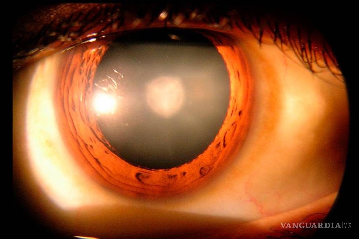 En millonésimas de segundo, tecnología de Centro Conacyt podría medir presión en ojo