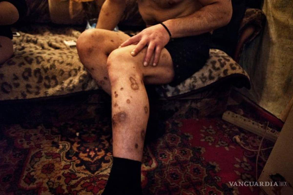 ¿Qué se siente, por qué los jóvenes consumen Krokodil?