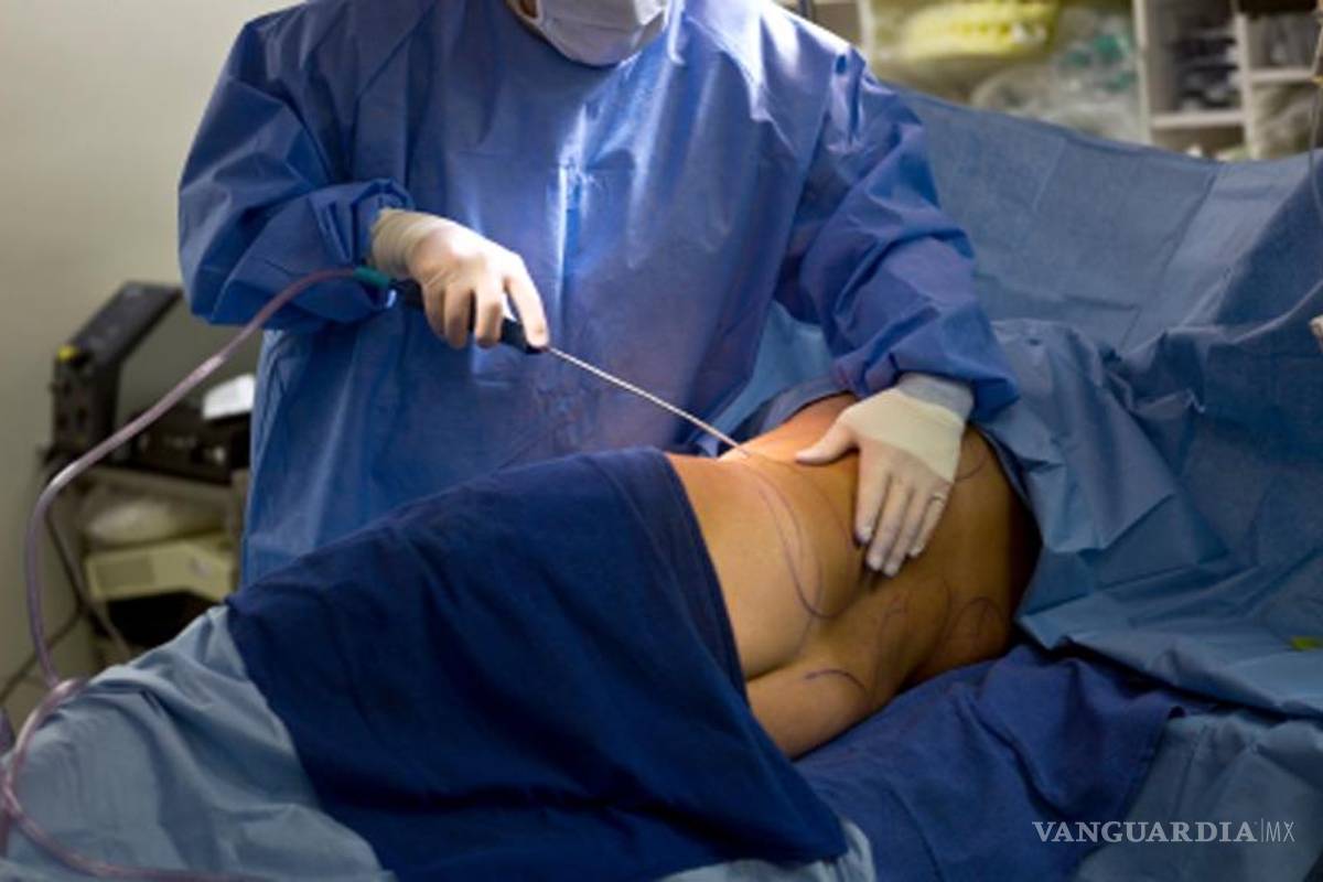 Muere mujer durante liposucción en clínica pirata