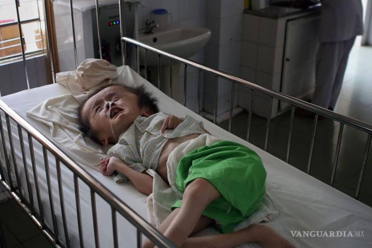 Los terribles efectos de los tóxicos usados por EU en Vietnam