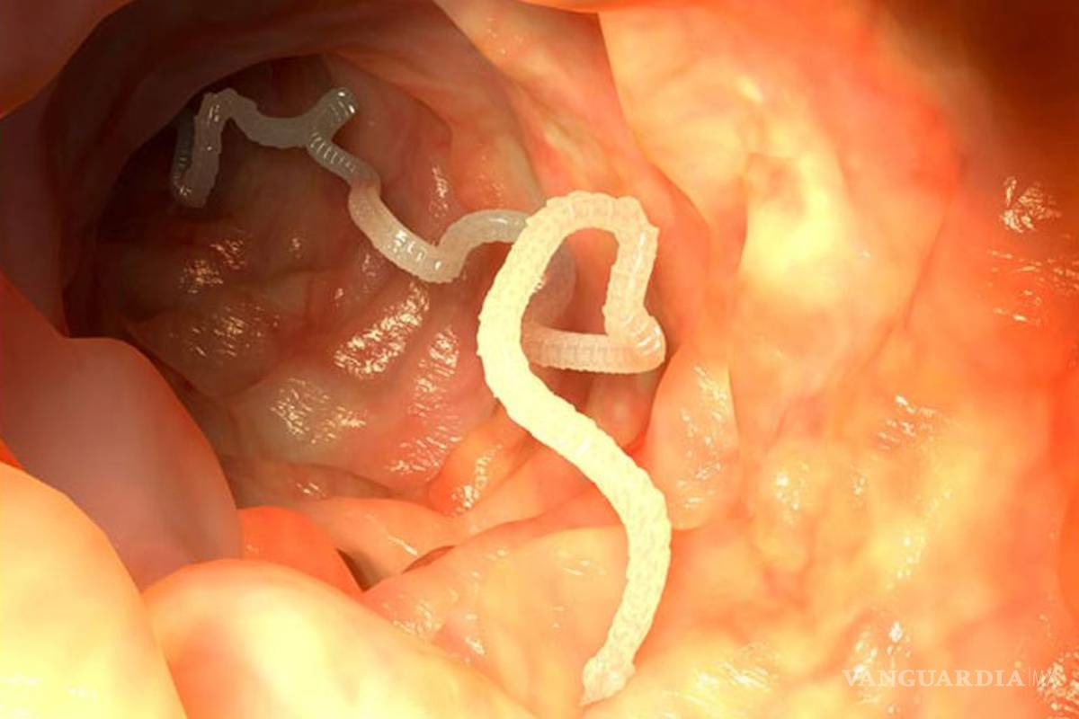 Cisticercosis, primera causa de epilepsia en México: experta