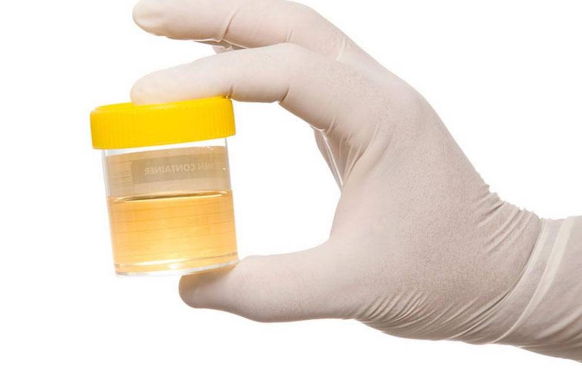 NASA convertirá orina en agua potable y electricidad