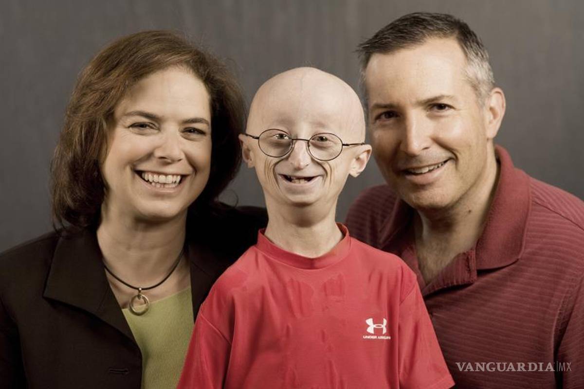 Muere Sam Berns, el adolescente con cuerpo anciano