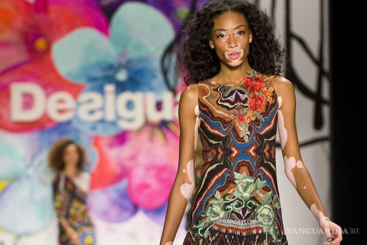 Winnie Harlow, la modelo diferente