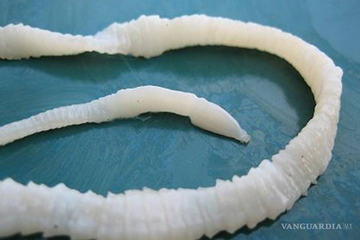 Mujer traga lombriz solitaria para perder peso