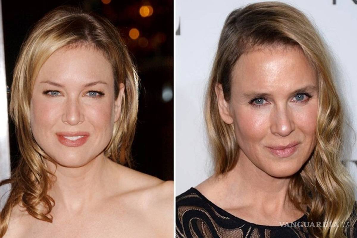 Muestran fotos de Renée Zellweger de su adolescencia