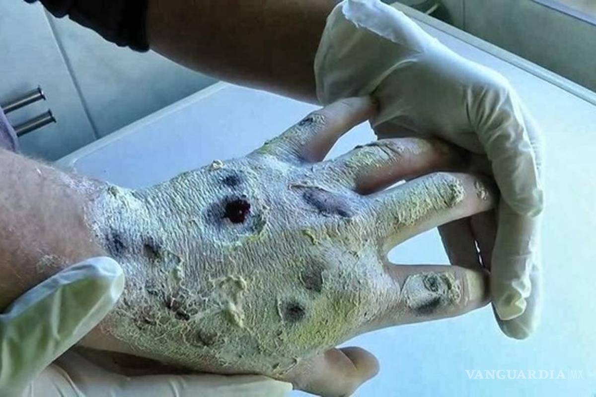 Autoridades redoblan vigilancia en fronteras por droga krokodil