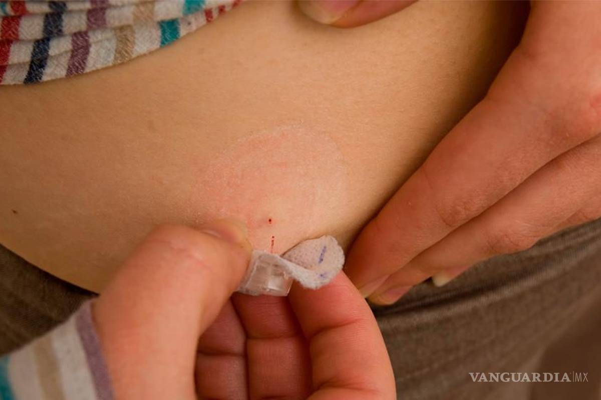 Desarrolla UNAM algoritmo para controlar diabetes I