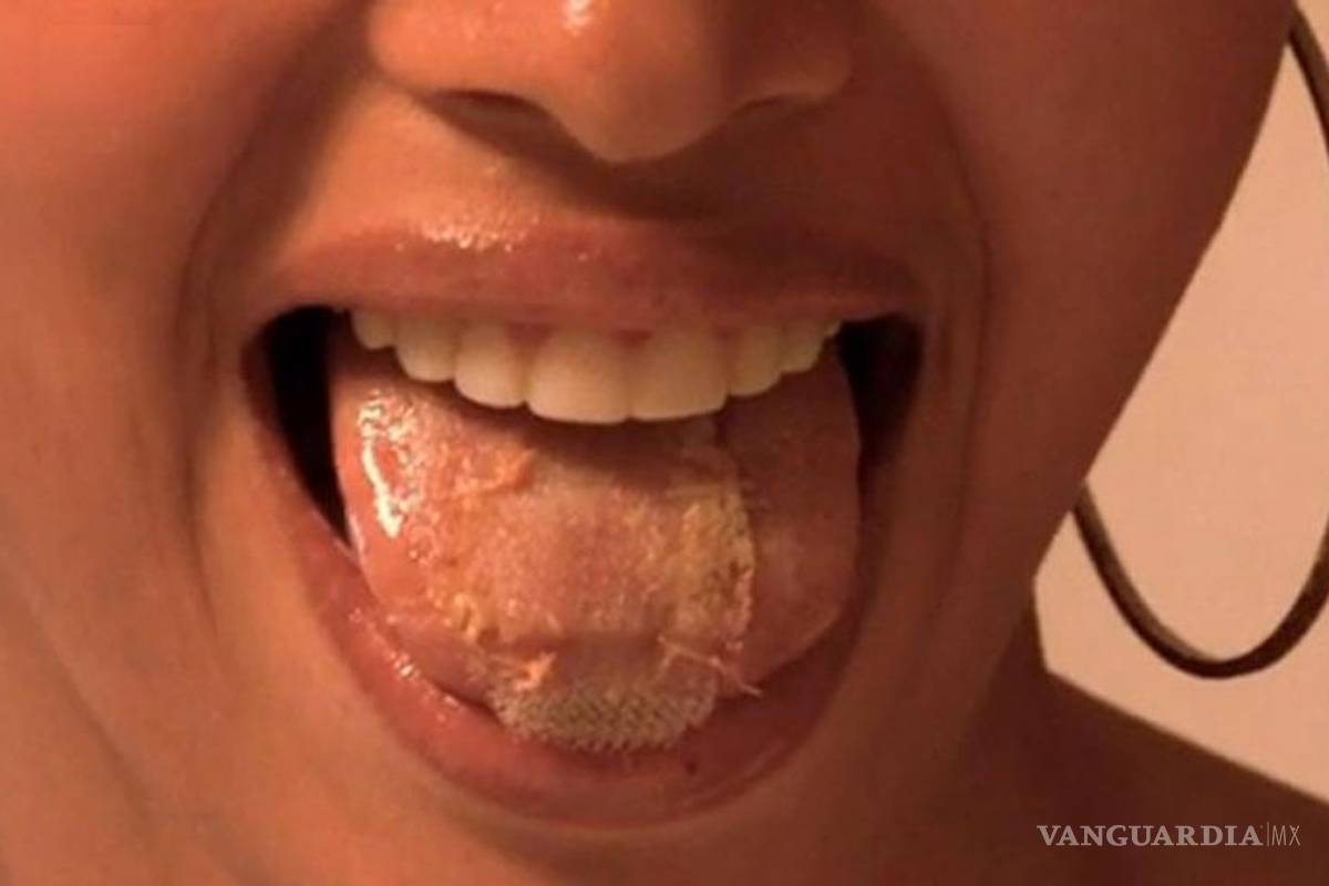 Modelos se cosen la lengua para bajar de peso