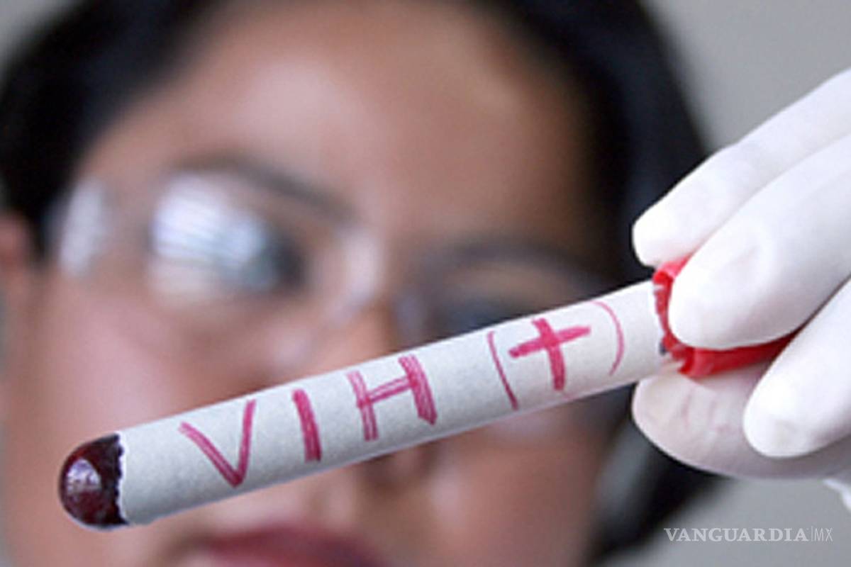 Aumentan casos de mujeres con VIH-Sida en México