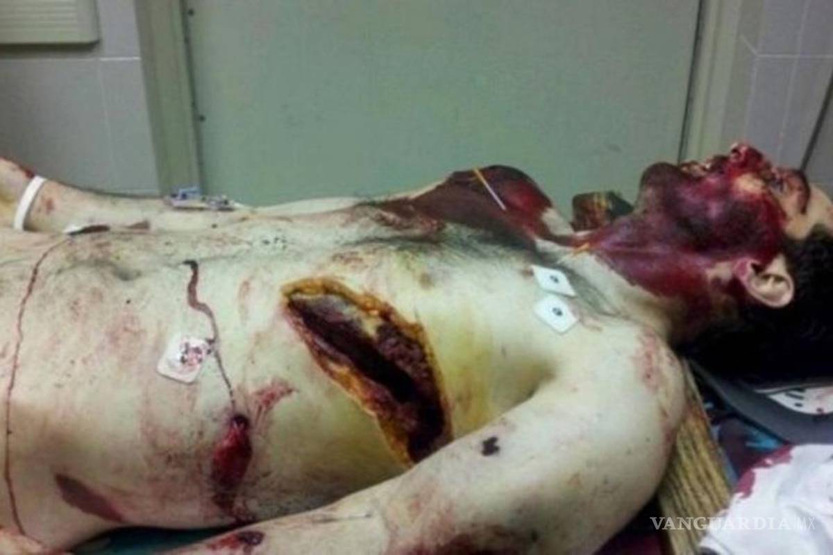Filtran supuesta foto de Tamerlan Tsarnaev muerto, sospechoso de Boston