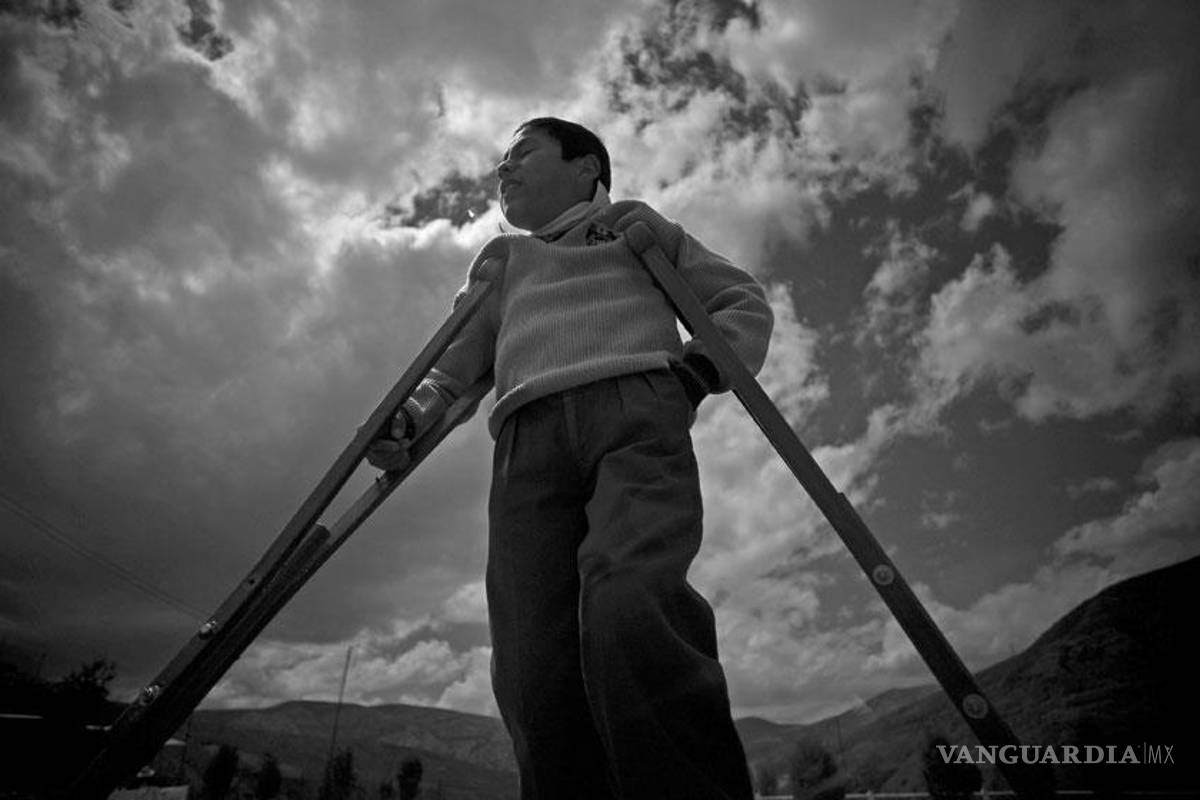 Enfermedad de Carrión, olvidada y letal