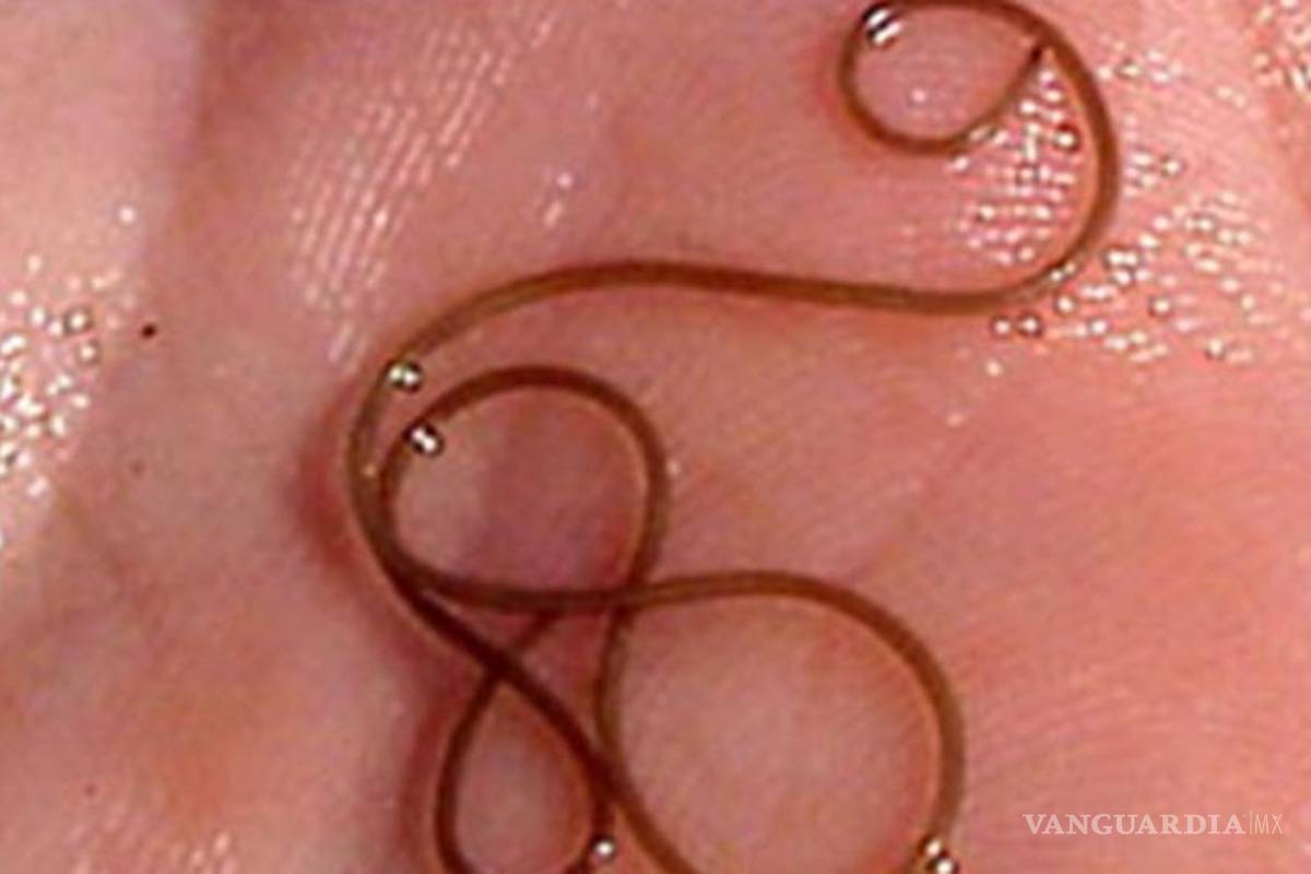 Cuidado con el gusano que lleva al suicidio