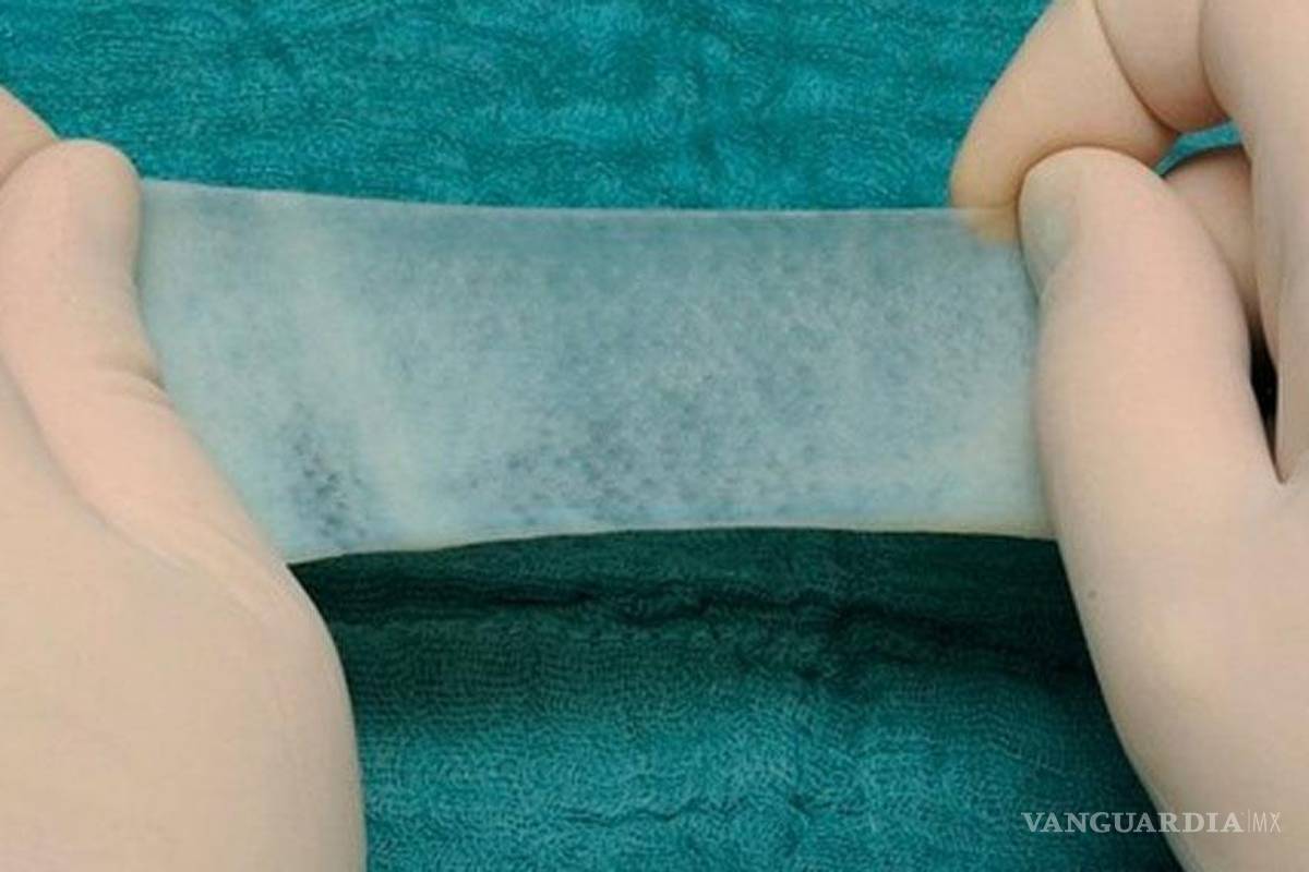 Mexicanos crean gasa biodegradable que acelera cicatrización