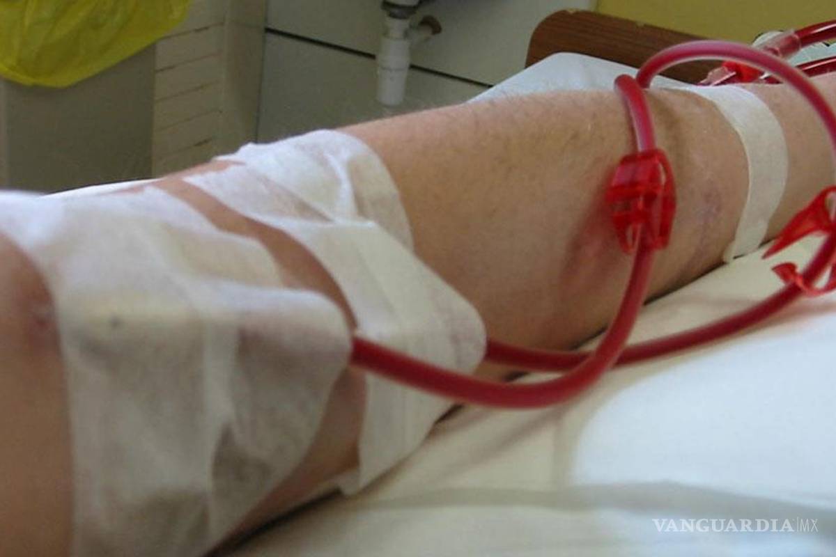 Más de 70 mil mexicanos necesitan diálisis y hemodiálisis